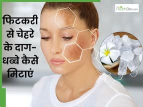 चेहरे के दाग धब्बे मिटाने के लिए फिटकरी में मिलाकर लगाएं ये 5 चीजें, खिल जाएगी त्वचा चेहरे के दाग धब्बे मिटाने के लिए फिटकरी में मिलाकर लगाएं ये 5 चीजें, खिल जाएगी त्वचा