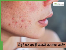 चेहरे के कुछ हिस्सों पर पपड़ी और रूखापन होने का क्या कारण है? जानें ठीक करने के उपाय