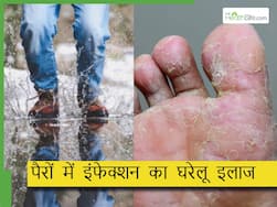 बरसात के पानी में भीगने से हो रहा है पैरों में इंफेक्शन तो आज से ही फॉलो करें ये 5 टिप्स, पैर रहेंगे हेल्दी