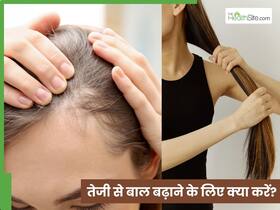 बालों की ग्रोथ के लिए सबसे बेस्ट क्या है? जानें कौन-सी 5 चीजें लगाने से बढ़ते हैं बाल बालों की ग्रोथ के लिए सबसे बेस्ट क्या है? जानें कौन-सी 5 चीजें लगाने से बढ़ते हैं बाल