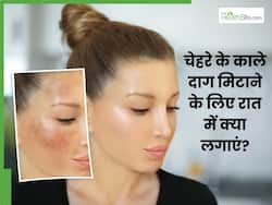 चेहरे के काले दाग मिटाने के लिए रात में क्या लगाएं? जानें 5 चीजें, जिनसे गायब हो जाएंगे डार्क स्पॉट्स