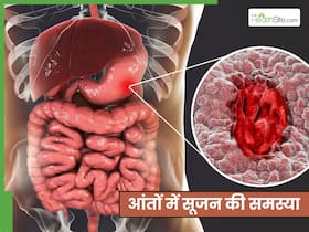 आंत में सूजन हो तो क्या दिक्कत होती है? जानें कैसे करें सूजन का इलाज