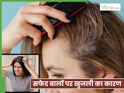 सफेद बालों की वजह से सिर पर खुजली होने पर क्या करें? 3 उपाय जो दूर करेंगे परेशानी