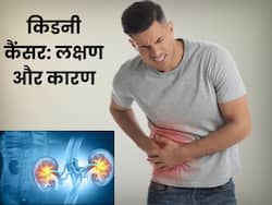 किडनी कैंसर क्या होता है? डॉक्टर से जानें लक्षण कारण और इलाज