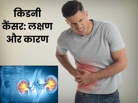 किडनी कैंसर क्या होता है? डॉक्टर से जानें लक्षण कारण और इलाज