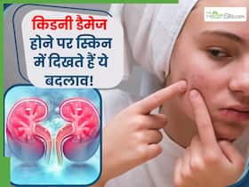 स्किन में दिखने वाले लक्षण सिर्फ नहीं एलर्जी ही नहीं बल्कि हो सकते हैं किडनी डैमेज का संकेत, कैसे लगाएं पता