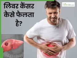 लिवर कैंसर कैसे होता है? जानें इस गंभीर बीमारी के लक्षण कारण और इलाज