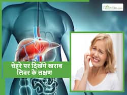 चेहरे में दिखने वाले ये 5 लक्षण कहीं फैटी लिवर का संकेत तो नहीं? इन बदलावों को न करें इग्नोर