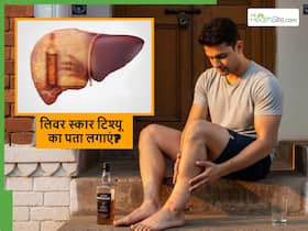 शराब पीने से लिवर में बनने लगते हैं Scar Tissue, ये 4 लक्षण हो रहे हैं तो गलती से भी न करें इग्नोर शराब पीने से लिवर में बनने लगते हैं Scar Tissue, ये 4 लक्षण हो रहे हैं तो गलती से भी न करें इग्नोर