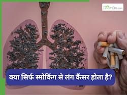 World Lung Day 2025: क्या सिर्फ धूम्रपान करने वाले लोगों को होता है लंग कैंसर, डॉक्टर बता रहे हैं सच्चाई