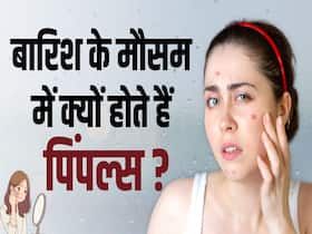 बारिश के मौसम में होने वाले पिम्पल से कैसे बचें?