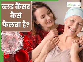 ब्लड कैंसर कैसे होता है? जानें इसके लक्षण, कारण और इलाज के विकल्प ब्लड कैंसर कैसे होता है? जानें इसके लक्षण, कारण और इलाज के विकल्प