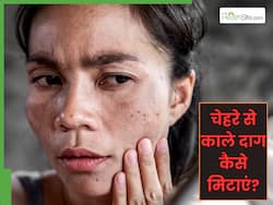 चेहरे से काले दाग कैसे साफ करें? जानें 2 असरदार नुस्खे, जो देंगे साफ चमकदार त्वचा