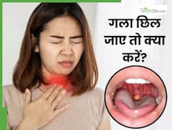 खांसते-छींकते गला छिल गया है तो करें ये घरेलू उपाय, दूर होगी खिच-खिच