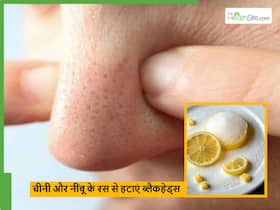 नाक के ब्लैकहेड्स को नींबू और चीनी की से कैसे साफ करें, सही इस्तेमाल से मिलेगा फायदा