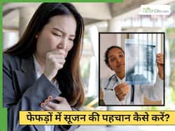 World Lung Day: рдлреЗрдлреЬреЛрдВ рдореЗрдВ рд╕реВрдЬрди рд╣реЛрдиреЗ рдкрд░ рджрд┐рдЦрддреЗ рд╣реИрдВ рдпреЗ 5 рд╕рдВрдХреЗрдд, рд╕рдордп рд░рд╣рддреЗ рджреЗрдВ рдзреНрдпрд╛рди