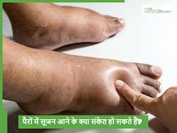 अचानक से पैरों सूजन आना कहीं हार्ट या किडनी की बीमारी तो नहीं? हो सकता है इन 5 जानलेवा बीमारियों का संकेत