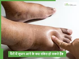अचानक से पैरों सूजन आना कहीं हार्ट या किडनी की बीमारी तो नहीं? हो सकता है इन 5 जानलेवा बीमारियों का संकेत