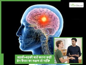 बहकी-बहकी बातें करना भी हो सकता है ब्रेन कैंसर का शुरुआती संकेत, बहुत कम लोग पहचानते हैं ये लक्षण बहकी-बहकी बातें करना भी हो सकता है ब्रेन कैंसर का शुरुआती संकेत, बहुत कम लोग पहचानते हैं ये लक्षण