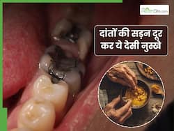 दांतों की सड़न दूर करे ये 5 देसी नुस्खे, बिना फिलिंग भर जाएंगे सारे दांतों के गड्डे