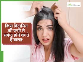 शरीर में इस विटामिन की कमी से सफेद होने लगते हैं बाल, काले और रेशमी बाल चाहिए तो खाना शुरु कर दें ये चीजें