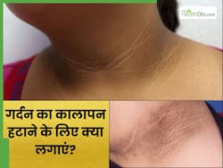 गर्दन का कालापन हटाने के लिए लगाएं ये 5 चीजें, चेहरे से करेगा मैच