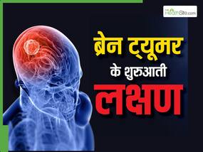बार-बार उल्टी आना ब्रेन कैंसर की ओर करता है इशारा, इन 5 संकेतों को गलती से भी न करें इग्नोर