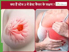 ब्रेस्ट कैंसर के 3 स्टेज में क्या होता है? जानिए इस स्टेज में दिखाई देने वाले लक्षण ब्रेस्ट कैंसर के 3 स्टेज में क्या होता है? जानिए इस स्टेज में दिखाई देने वाले लक्षण