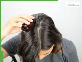 How To Use Castor Oil For Hair Regrowth On Bald Patches, Proper Massage Technique Explained