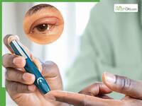 Diabetic Eyes: 10 Warning Signs Your Blood Sugar Level Is Too High