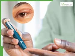 Diabetic Eyes: 10 Warning Signs Your Blood Sugar Level Is Too High
