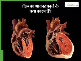दिल का साइज क्यों बढ़ जाता है? जानिए इसके कारण और इलाज