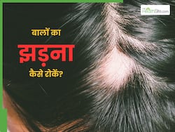 1 दिन में 300 से भी ज्यादा बाल झड़ रहे हैं बाल? तो तुरंत आजमाएं ये देसी नुस्खे, जल्द दिखने असर