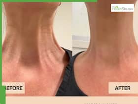 How Can You Remove Neck Lines Naturally and Tighten Sagging Skin? 4 Simple Exercises That Work