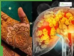 Henna May Help Reverse Liver Damage And Repair Liver Fibrosis, Says Japanese Study