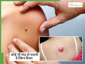 शरीर में बनी कोई भी गांठ हो सकती है कैंसर? इन 5 लक्षणों की जांच करके हो जाएगा कन्फर्म शरीर में बनी कोई भी गांठ हो सकती है कैंसर? इन 5 लक्षणों की जांच करके हो जाएगा कन्फर्म