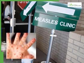 South Carolina Measles Outbreak: 8 Unvaccinated Cases Spark Health Emergency in Upstate Region South Carolina Measles Outbreak: 8 Unvaccinated Cases Spark Health Emergency in Upstate Region