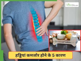 ऑस्टियोपोरोसिस की समस्या को बढ़ाती हैं ये 5 आदतें, आज ही से शुरू करें सुधारना
