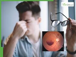 Man Suffers Sudden Vision Loss After Weightlifting, Diagnosed With Rare Eye Condition Valsalva Retinopathy