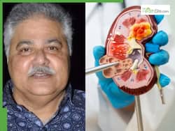 Satish Shah Passes Away Due To Kidney Failure: Common Complications Post Transplant And How To Manage Them