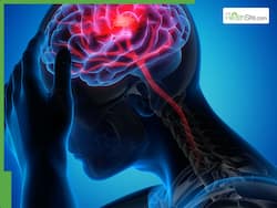 Stroke Symptoms In Women Vs Men: Know The Early Warning Signs Before It   s Too Late