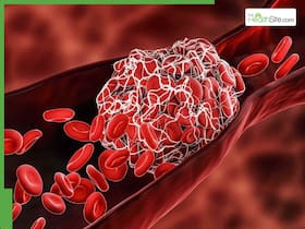 World Thrombosis Day 2025: 7 Early Signs Of Blood Clots You Should Never Ignore