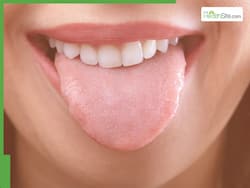 5 Warning Signs On Your Tongue That Could Point To Dangerous Diseases