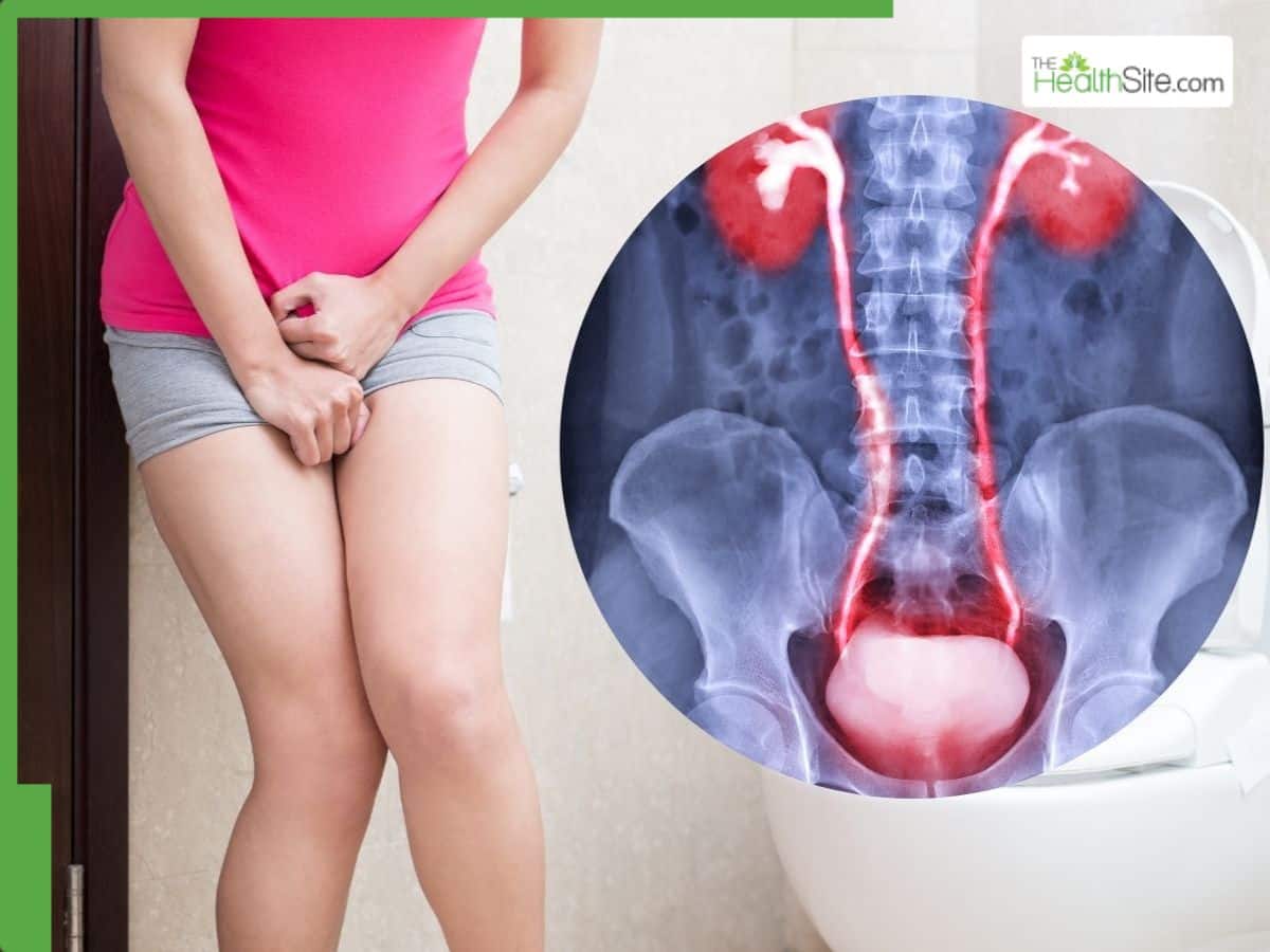 UTI Management In Winter: How To Cure Urinary Tract Infection At Home – Simple Tips To Follow