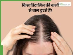 शरीर में किस विटामिन की कमी से बाल टूटते हैं? जानें, कैसे करें इसकी पूर्ति