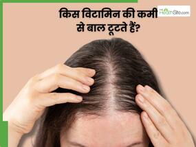 शरीर में किस विटामिन की कमी से बाल टूटते हैं? जानें, कैसे करें इसकी पूर्ति