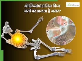 ऑस्टियोपोरोसिस में झुकने लगती हैं हड्डियां, शरीर का ये 3 अंग सबसे ज्यादा होता है प्रभावित ऑस्टियोपोरोसिस में झुकने लगती हैं हड्डियां, शरीर का ये 3 अंग सबसे ज्यादा होता है प्रभावित