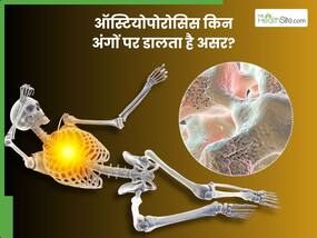 ऑस्टियोपोरोसिस में झुकने लगती हैं हड्डियां, शरीर का ये 3 अंग सबसे ज्यादा होता है प्रभावित