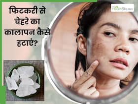 चेहरे का कालापन हटाने के लिए फिटकरी में मिलाकर लगाएं ये 5 चीजें, पूरी तरह गायब हो जाएगी डार्कनेस