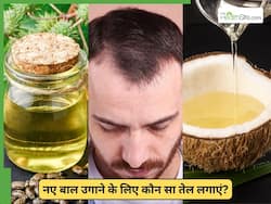 कैस्टर ऑयल या नारियल का तेल, नए बाल उगाने के लिए कौन सा तेल सही है?
